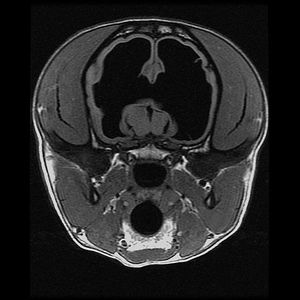 what causes hydrocephalus dogs